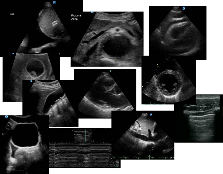 Point of Care Ultrasound Critical Care Sonography